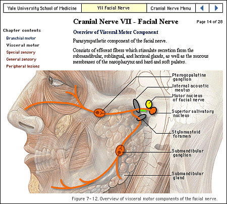Screen shot: Labeled anatomic graphic on Cranial Nerves page