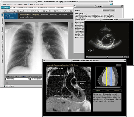 Screen shot: Set of pages from Cardiothoracic Imaging site